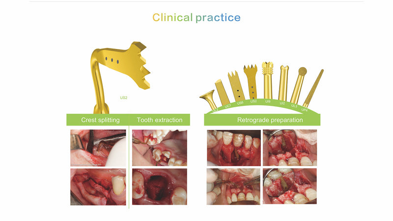 Woodpeckr surgic-touch, piezo for bone surgery, endodontic, periodontic, bone function