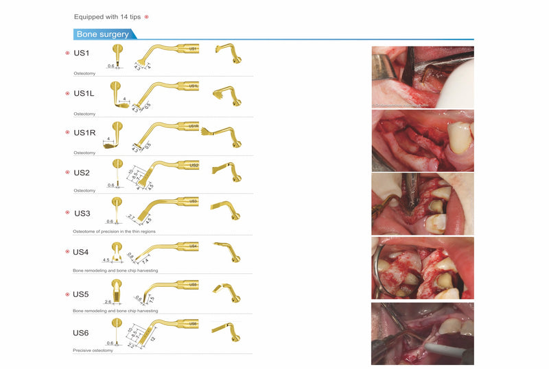 Woodpecker surgic-touch, piezo for bone surgery, endodontic, periodontic, bone function